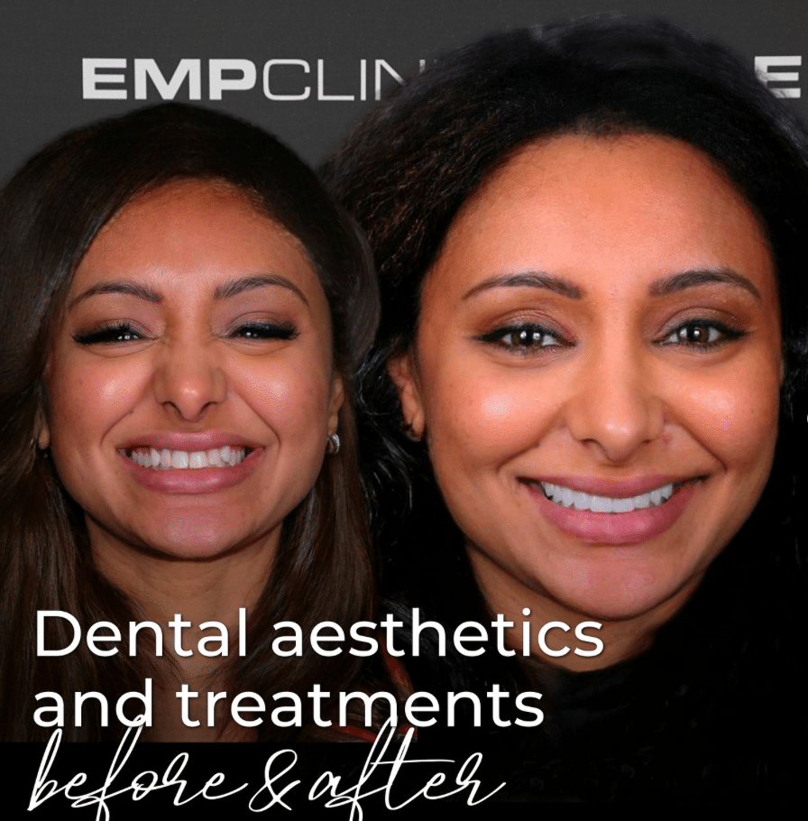 Smile Makeover Istanbul